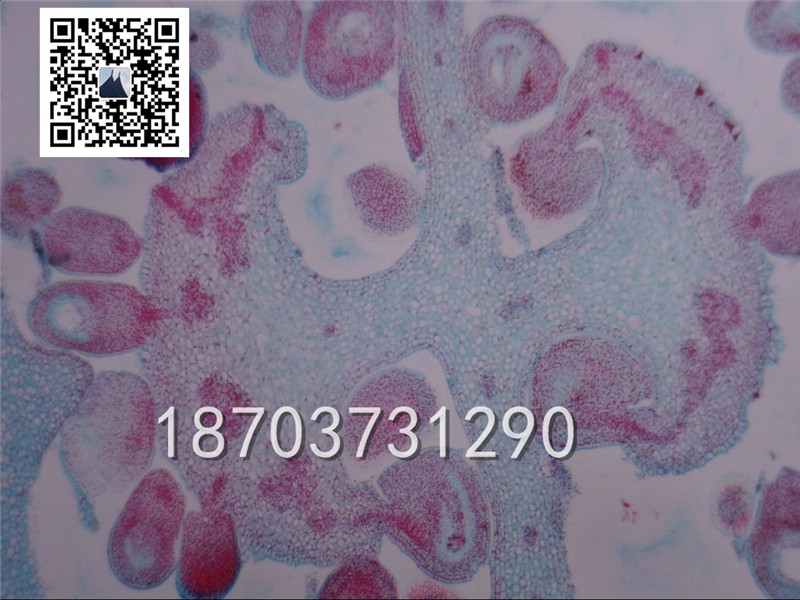 洋金花花蕾橫切